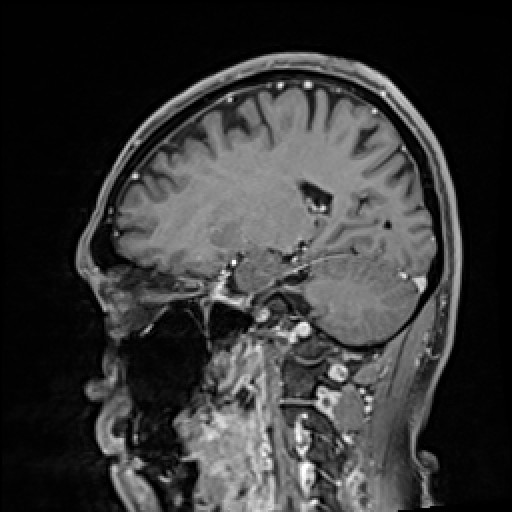 Click on the Serie image to view the images of VILLANUEVA, WILLIAM A.